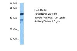 ZDHHC9 Rabbit anti-Human, Polyclonal, Novus Biologicals 0.1ml; Unconjugated:Antibodies,